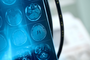 Графический результат обследования